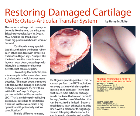restoring-damaged-cartilage